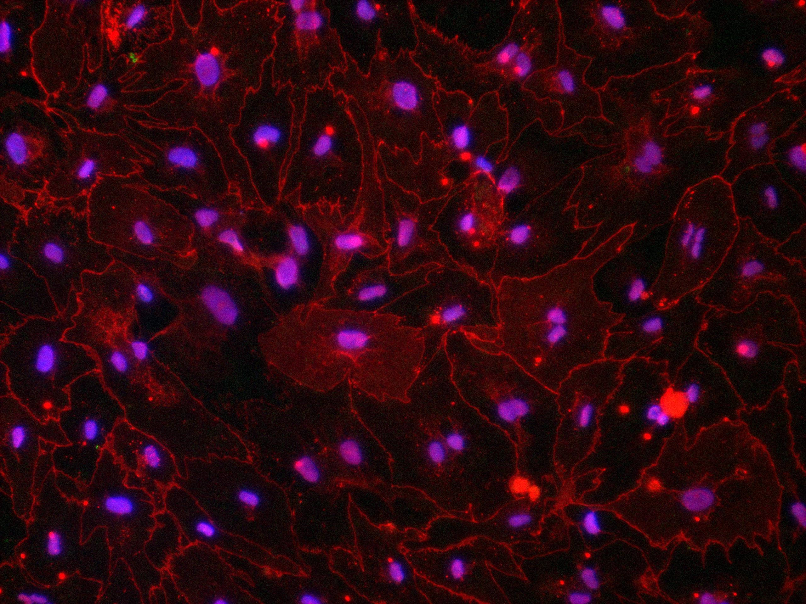 Claudin-5 fluorescence microscopy — Zürich, 2013